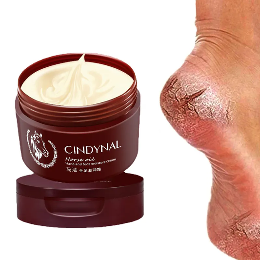 Anti-Fungal Foot Repair Cream – Cracked Heel & Dead Skin Care