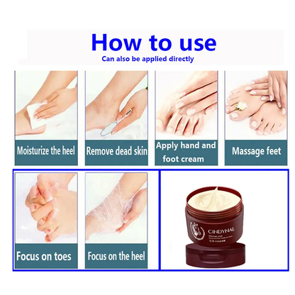 Anti-Fungal Foot Repair Cream – Cracked Heel & Dead Skin Care