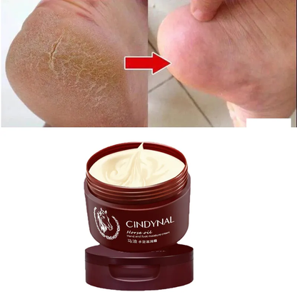 Anti-Fungal Foot Repair Cream – Cracked Heel & Dead Skin Care