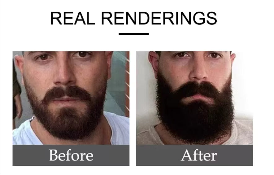 Organic Beard Growth Serum & Beard Oil for Men