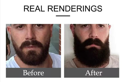 Organic Beard Growth Serum & Beard Oil for Men