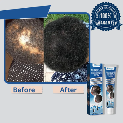 Alopecia Hair Growth Cream – Nourishing Hair Care Formula organic