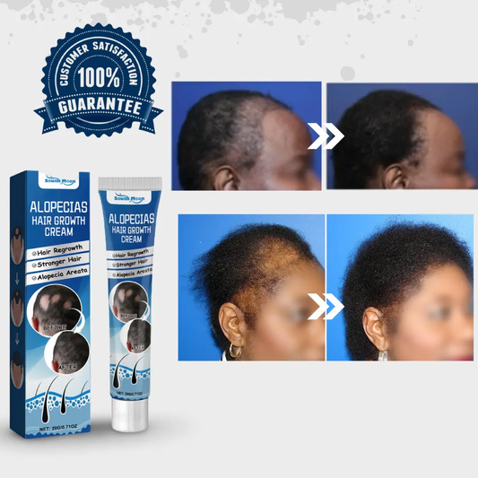 Alopecia Hair Growth Cream – Nourishing Hair Care Formula organic