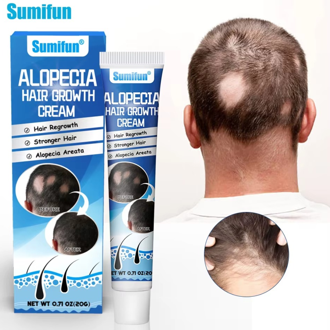 Alopecia Hair Growth Cream – Nourishing Hair Care Formula organic