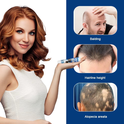 Alopecia Hair Growth Cream – Nourishing Hair Care Formula organic